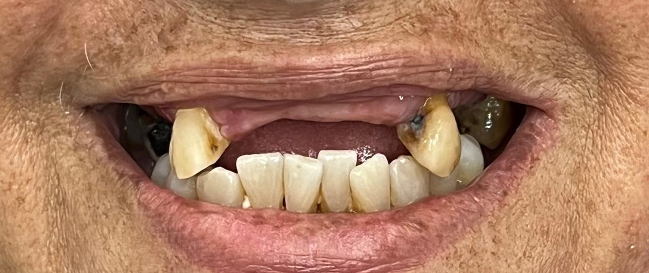 Prancheta 2 copiar 2