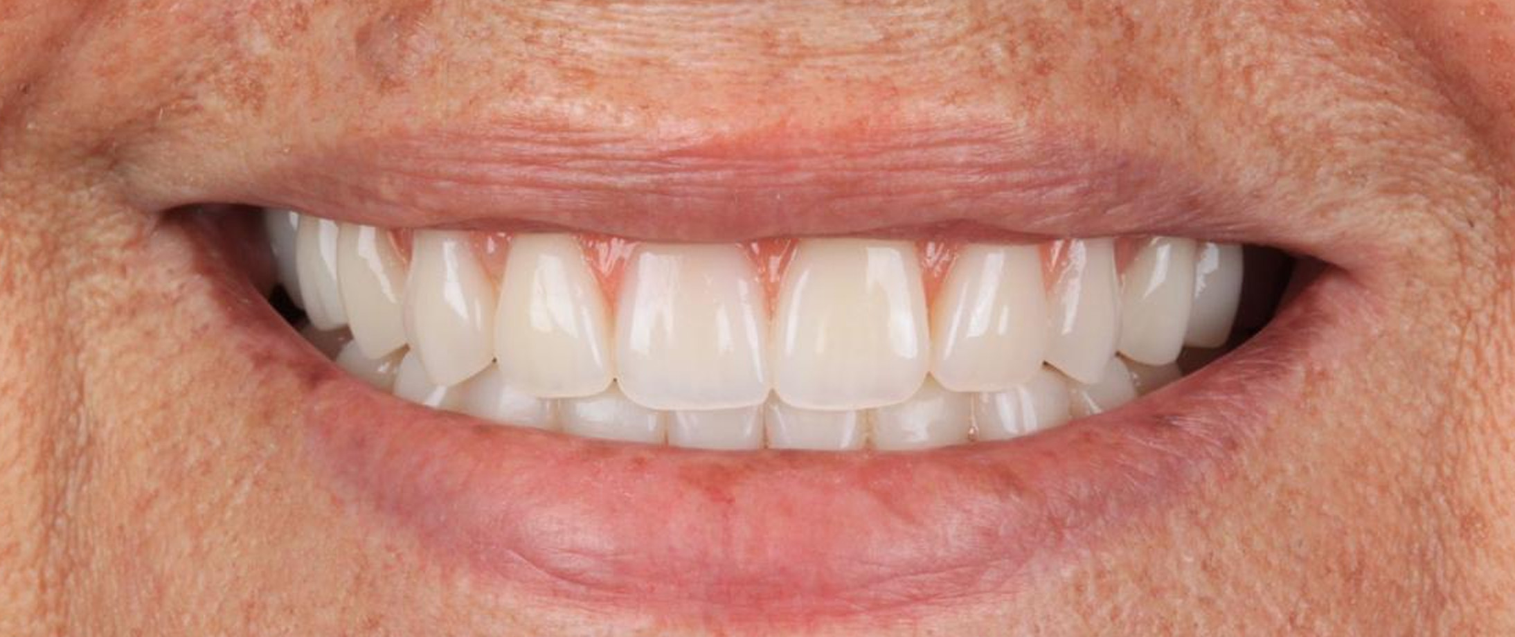 Prancheta 2 copiar 3