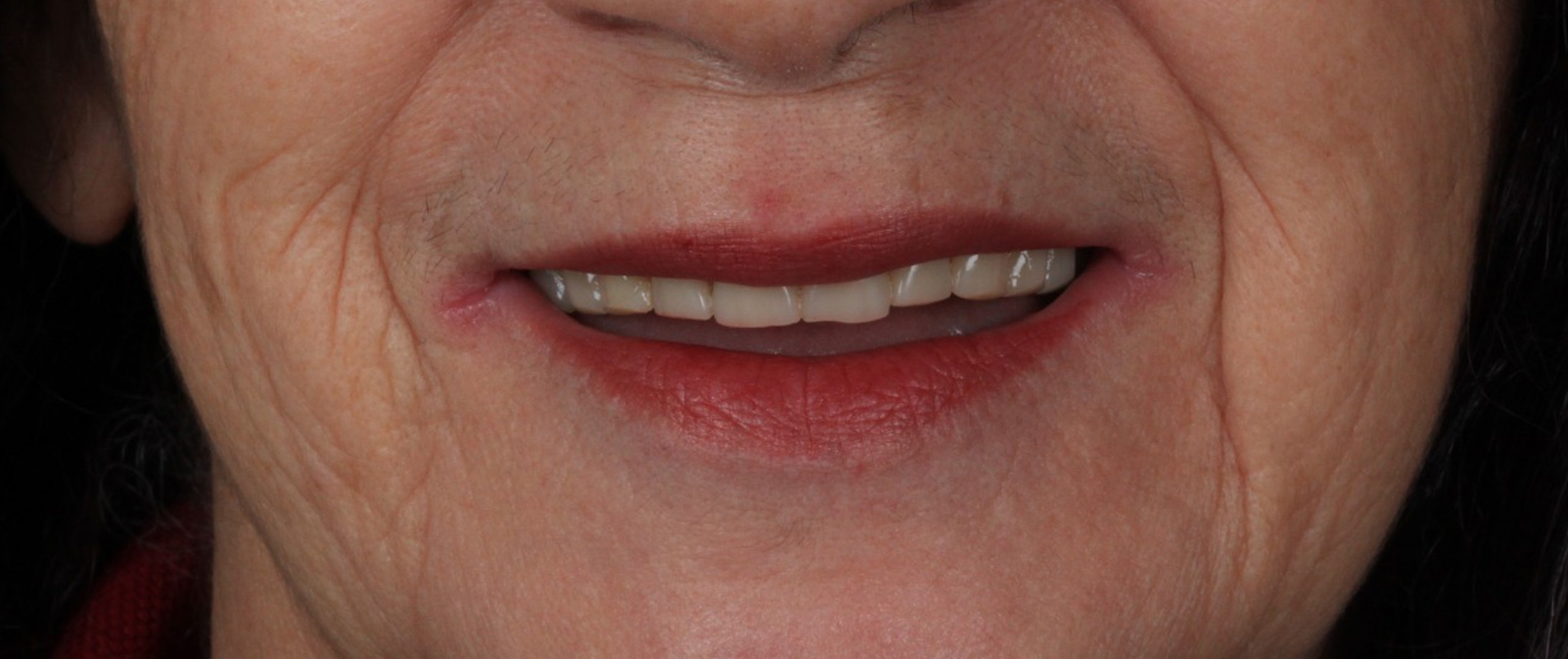 Prancheta 2 copiar 4